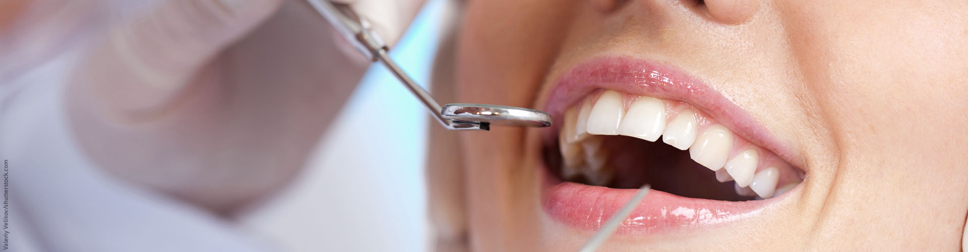 Erhaltung des Zahnstandes nach kieferorthopdischer Behandlung