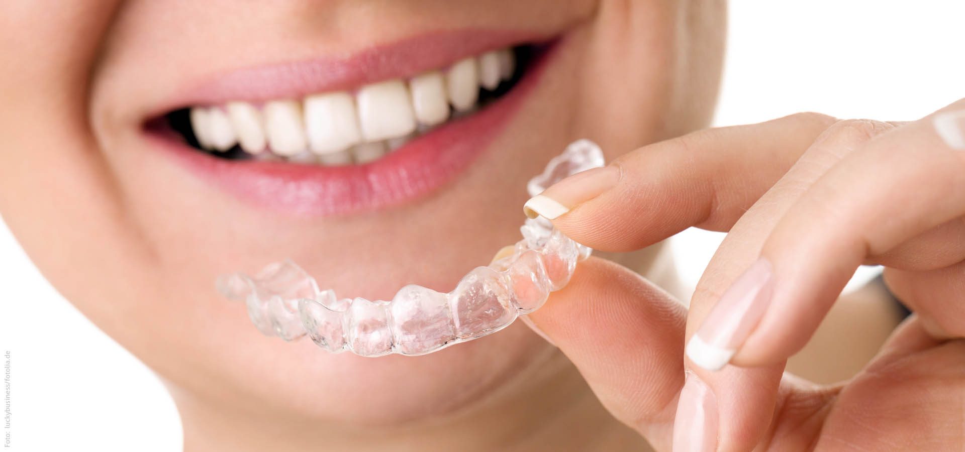 Unsichtbare Zahnregulierung durchsichtige Zahnspange
